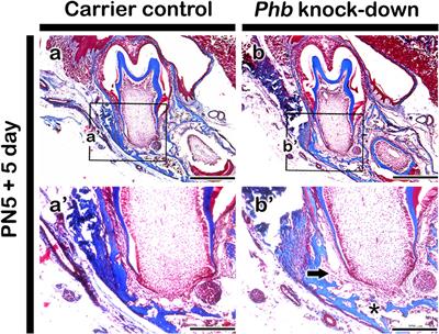 Prohibitin modulates periodontium differentiation in mice development